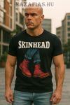SKINHEAD